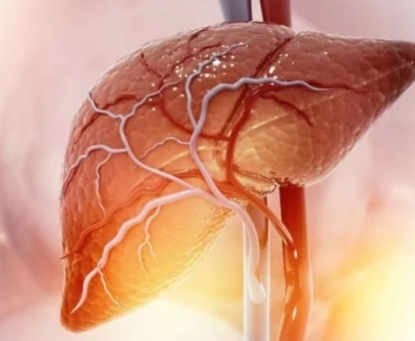 Phẫu thuật nội soi thu nhỏ dạ dày có cải thiện bệnh gan nhiễm mỡ không?